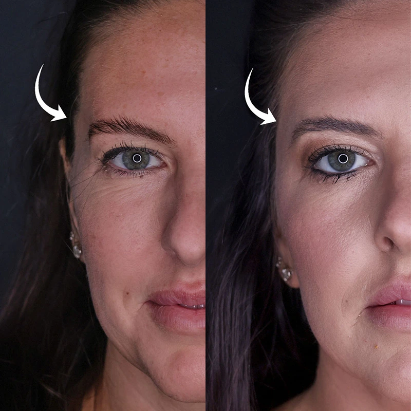 9نکته که باید قبل از استفاده از پرکننده های صورت بدانیدhttps://dermatologyclinic.ir