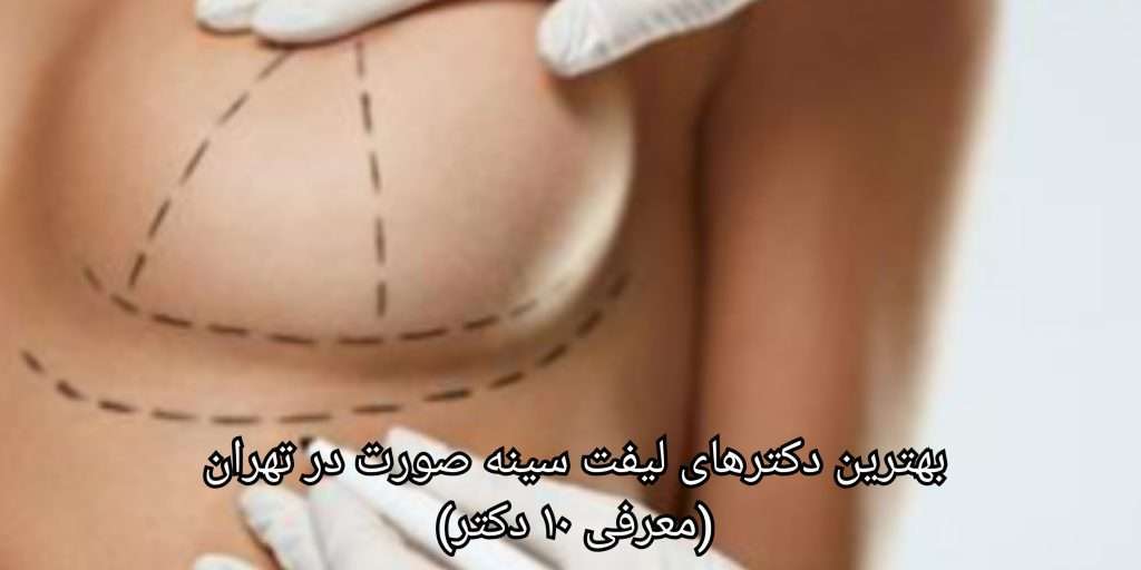 لیست بهترین دکترهای لیفت سینه در تهران 