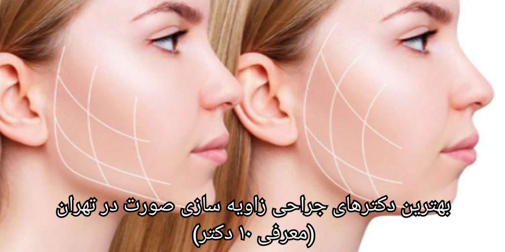 سوالات متداول متخصص جراحی زاویه سازی صورت در ایران