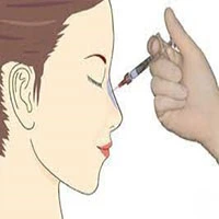 6 نکته ای که باید در مورد پرکننده بینی بدانید-https://dermatologyclinic.ir