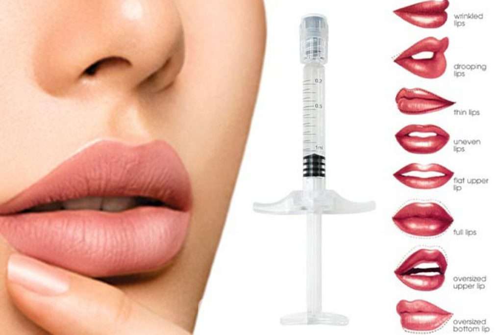 تزریق ژل طبیعی 