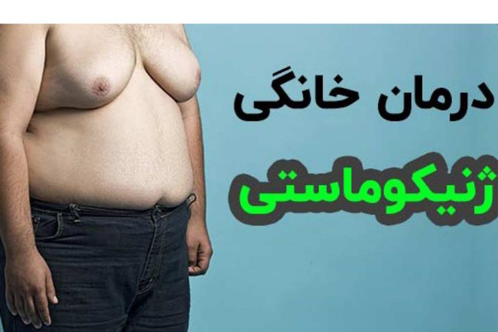 ژنیکوماستی 