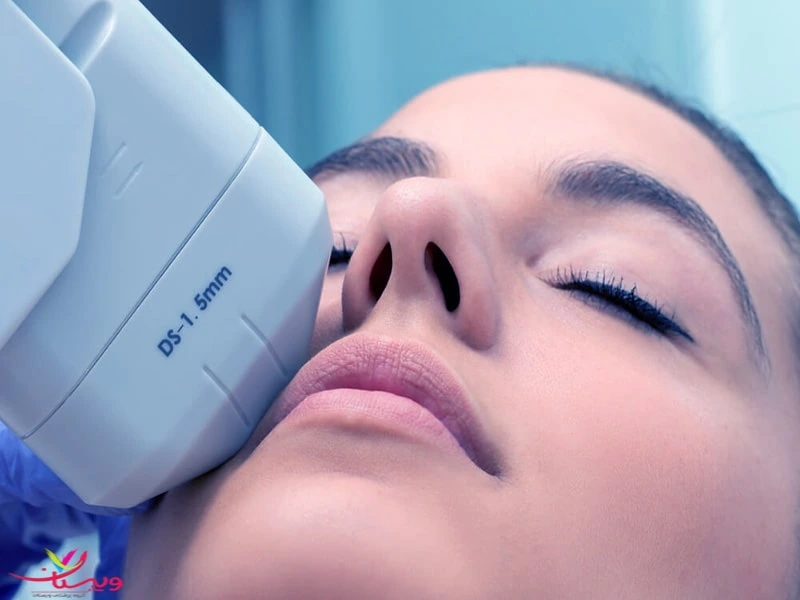 فواید هایفوتراپی دابلو-https://dermatologyclinic.ir