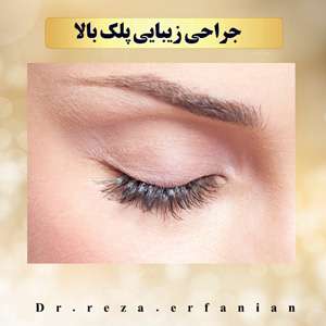 افتادگی پلک (پتوز)