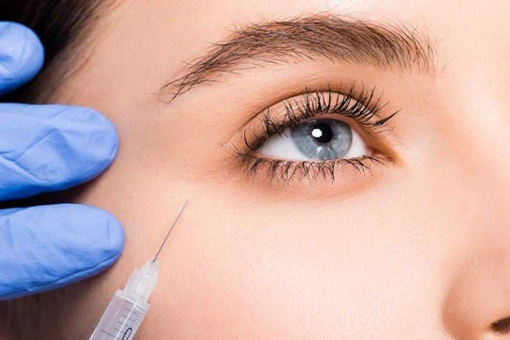 روش کربوکسی تراپی زیر چشم