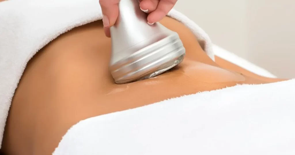 لاغری شکم با دستگاه کویتیشن