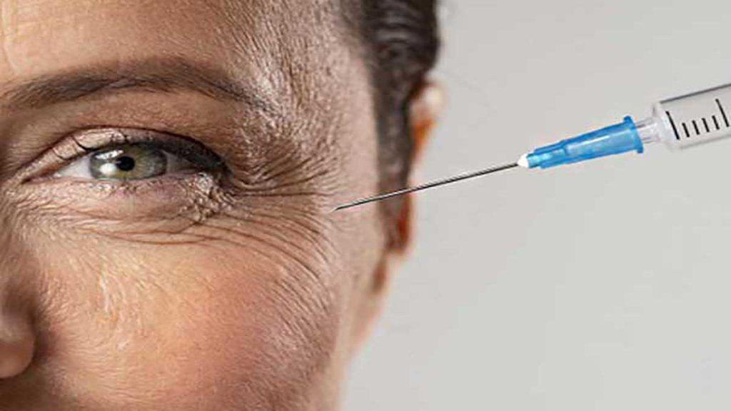 تزریق بوتاکس چروک های کنار چشم