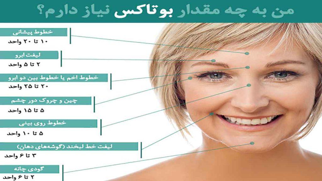 مقدار بوتاکس مورد نیاز نواحی صورت