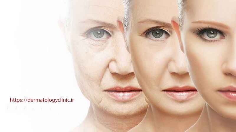 جوانسازی پوست با هایفوتراپی