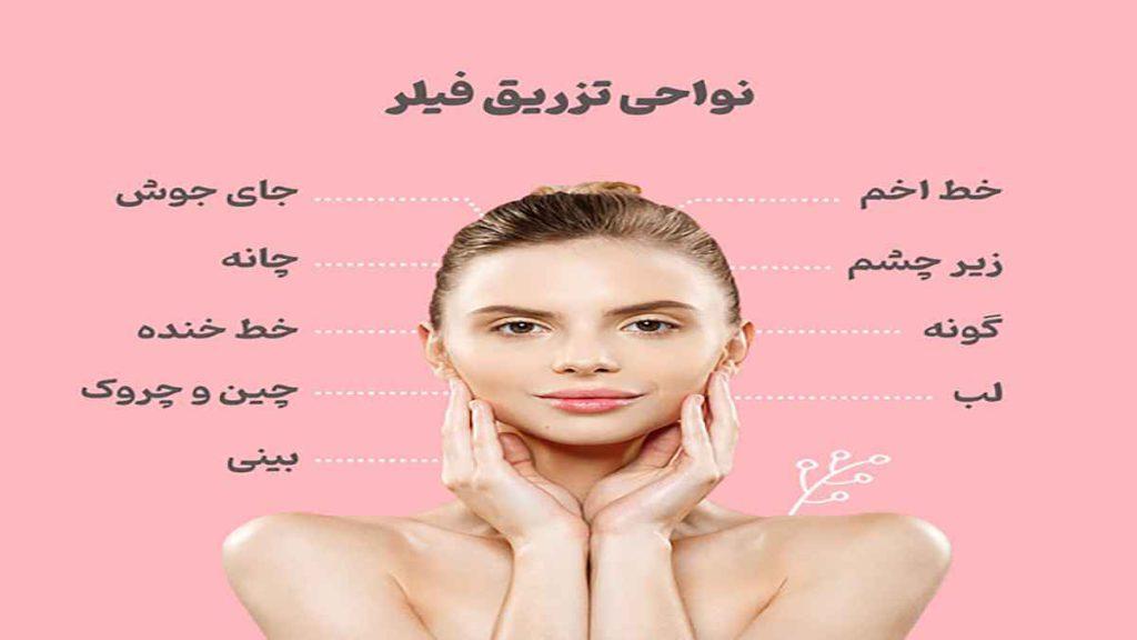 نواحی تزریق فیلر لب از نظر پزشک متخصص در کلینیک زیبایی ویستان