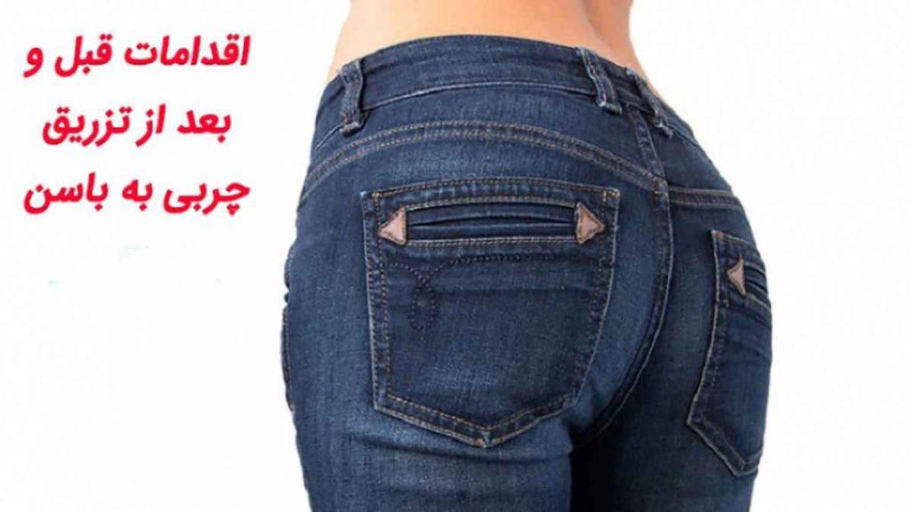 اقدامات قبل از تزریق چربی