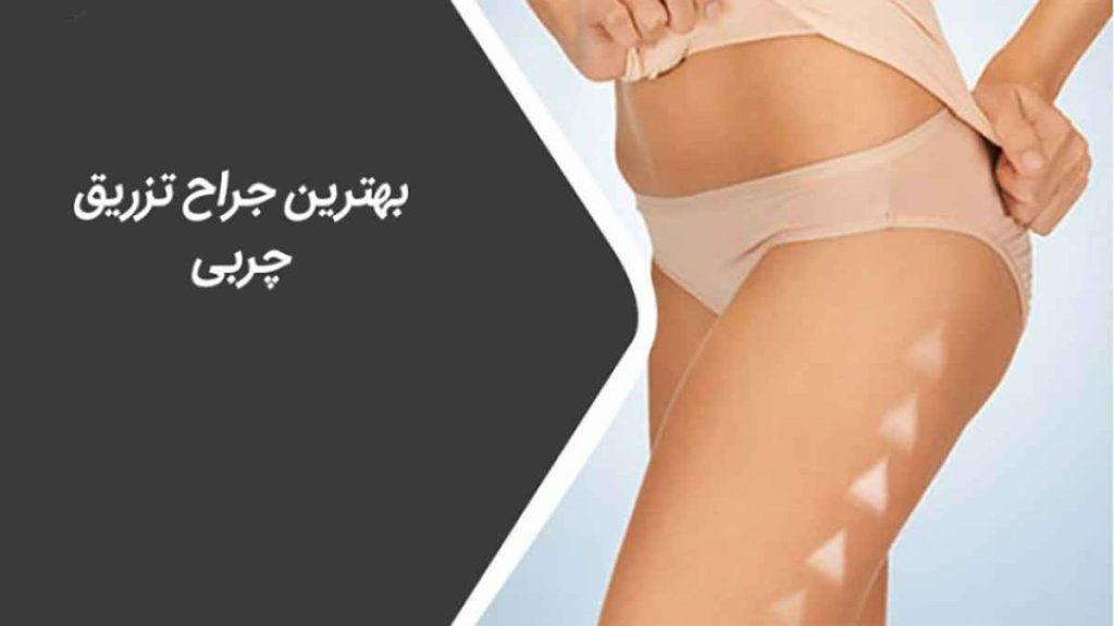 بهترین جراح زیبایی در تهران