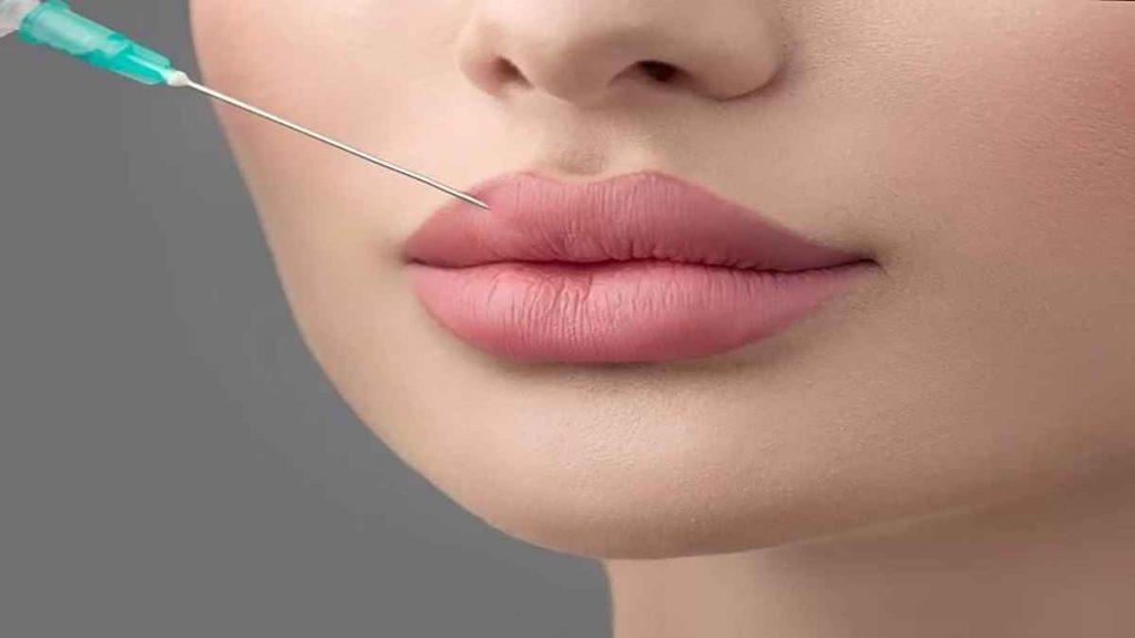 تزریق ژل به لب و فرم دهی لب