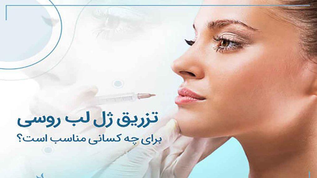 تزریق ژل به لب در تهران