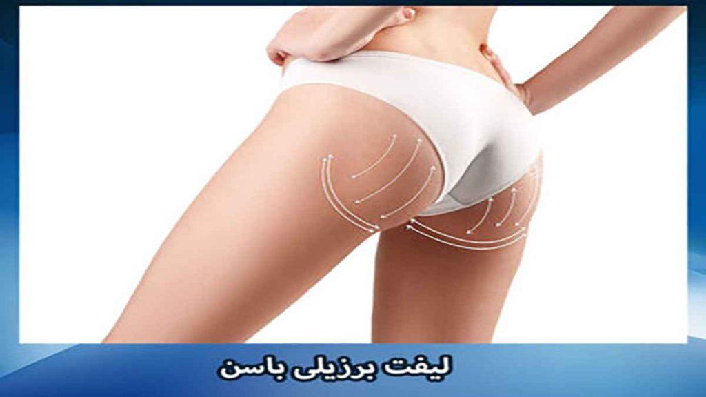 لیفت باسن برزیلی