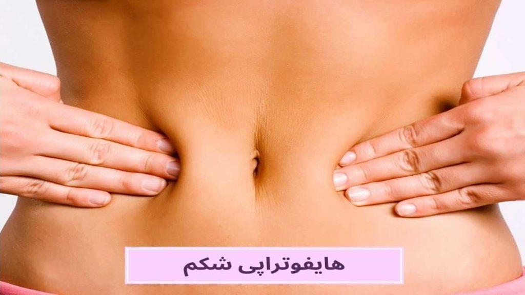 تعرفه هایفوتراپی قیمت هایفوتراپی شکم