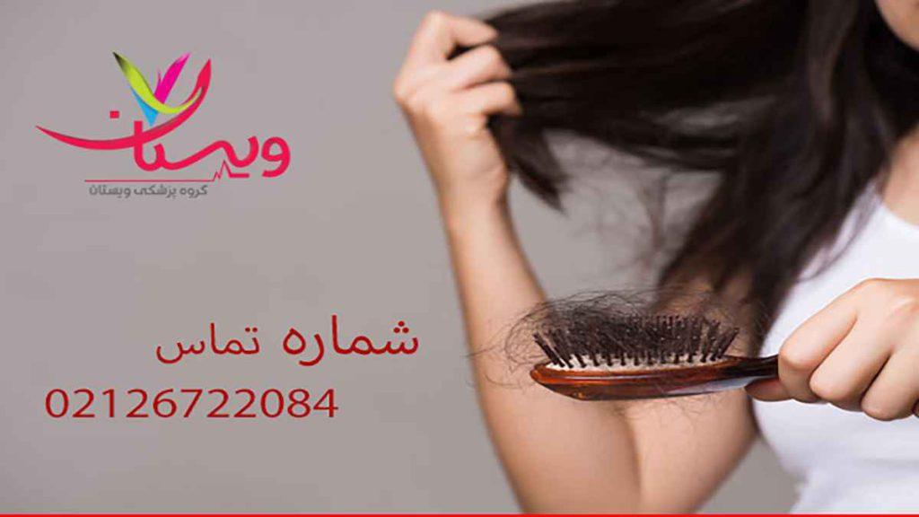انواع درمان ریزش مو