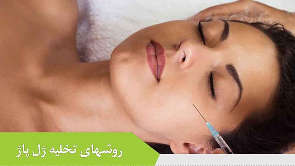 روش های تخلیه ژل