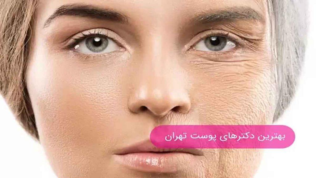 دکتر پوست بهترین دکتر پوست