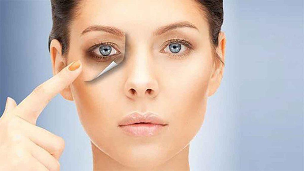 تاثیر مزوتراپی تاثیر مزوتراپی