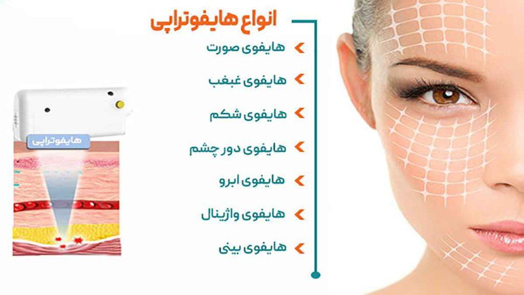انواع هایفوتراپی