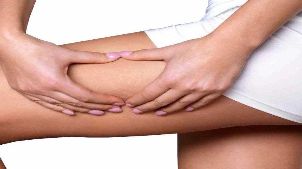 هایفوتراپی ران پای زن