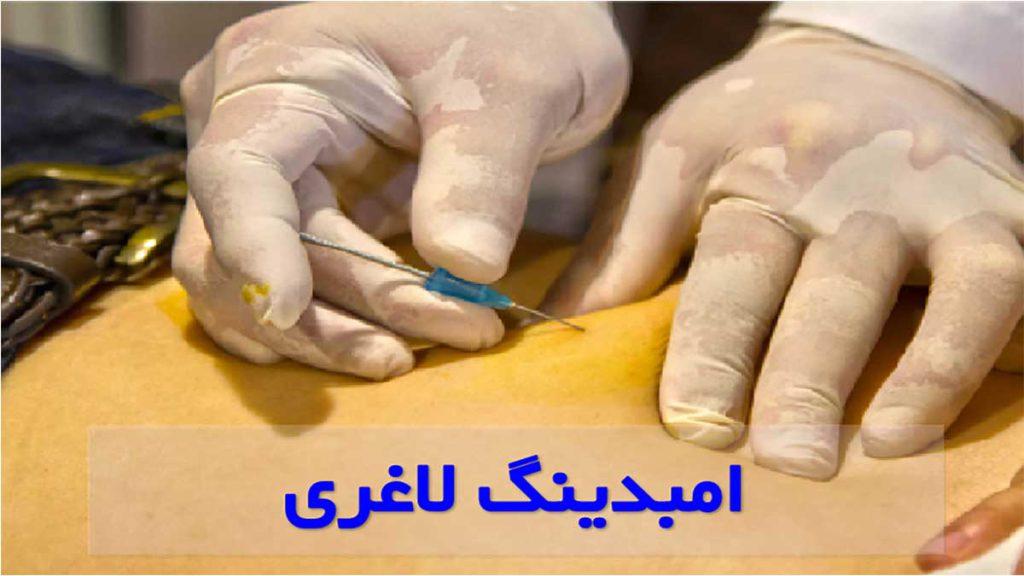عوارض ایمبدینگ شکم کدامند