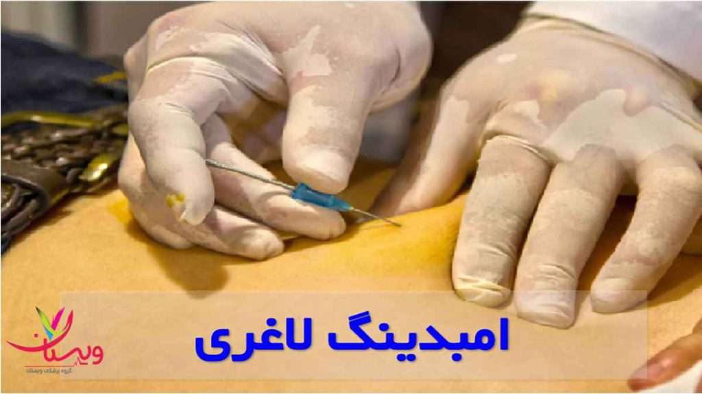 امبدینگ لاغری کاشت نخ برای کمر