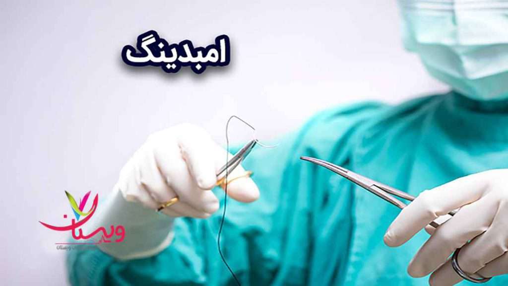 نخ لاغری کاشت نخ یا امبدینگ