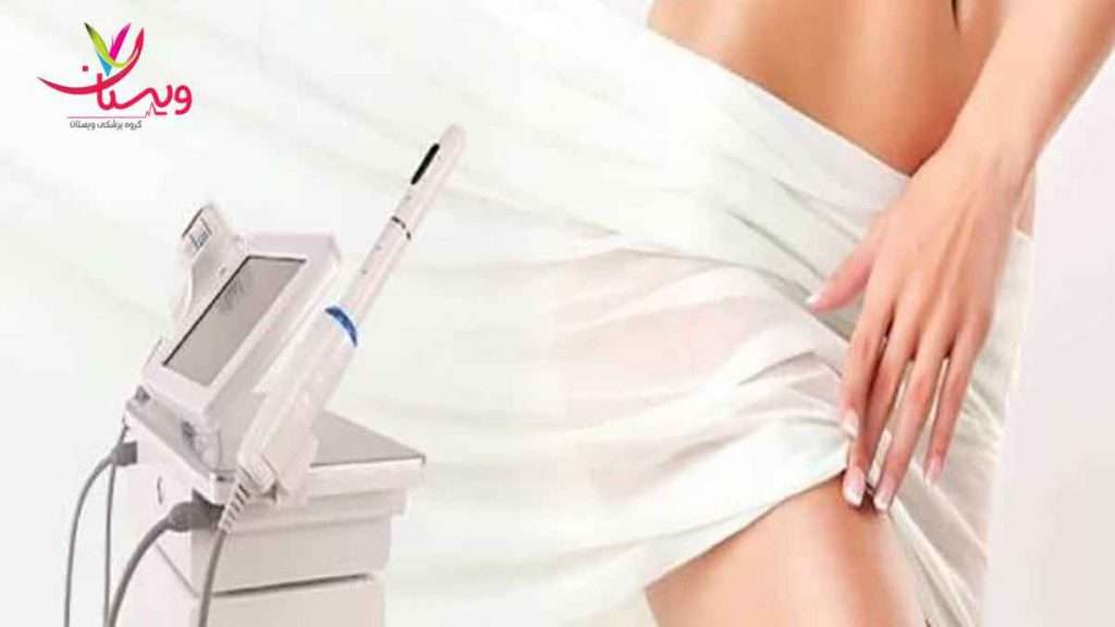 هزینه هایفو واژینال