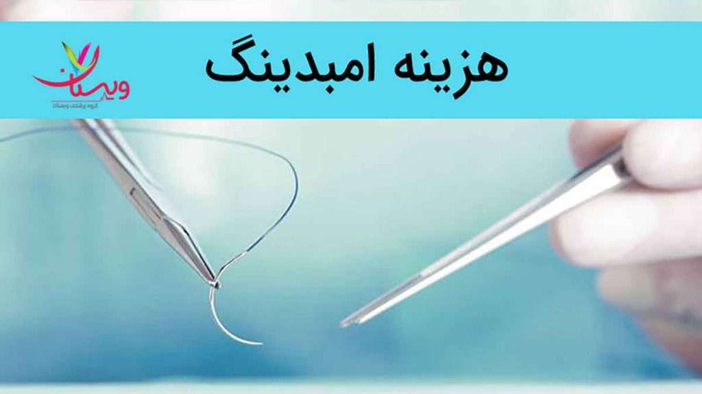 هزینه امبدینگ هزینه امبدینگ