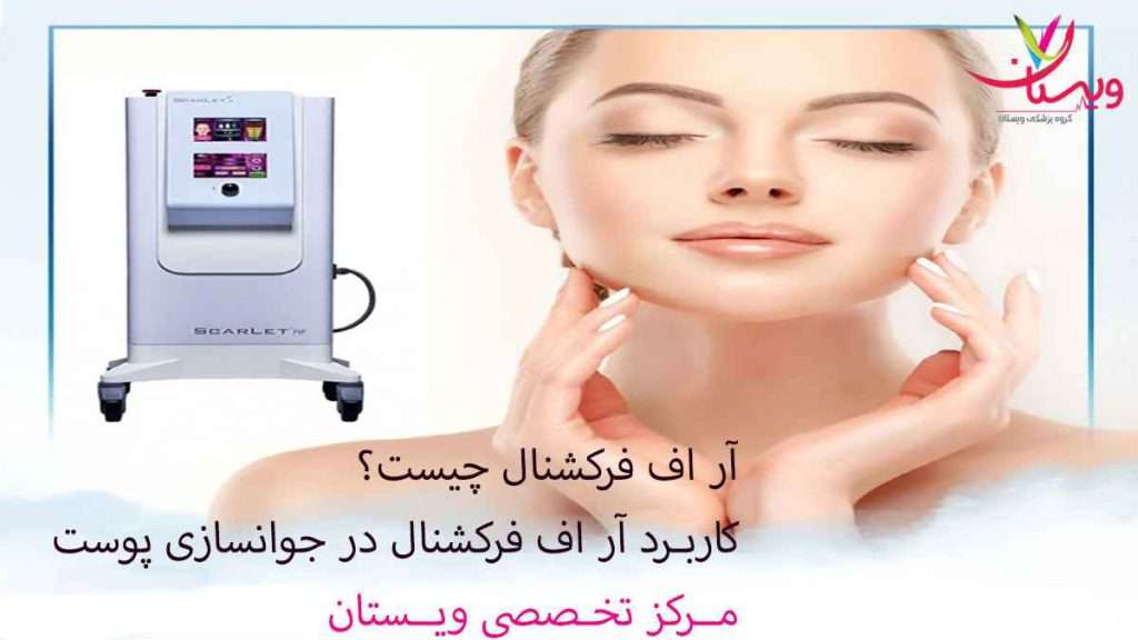 آر اف فرکشنال چیست؟