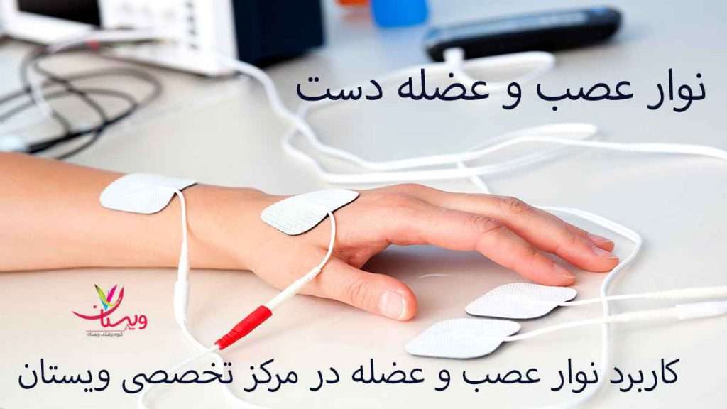 نوار عصب و عضله