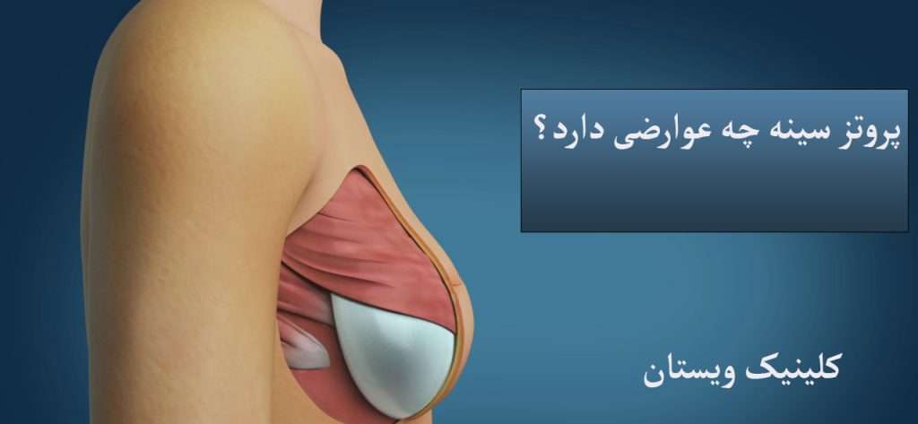 سینه فرد برای پروتز نشان داده می شود