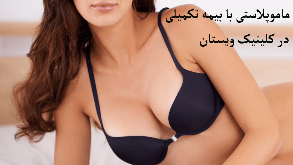 شخصی با ماموپلاستی به نتیجه دلخواه خود رسیده است