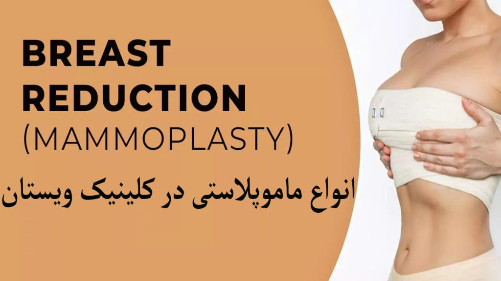 نتایج ماموپلاستی نمایش داده می شود