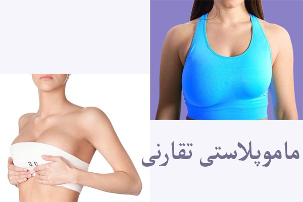 قبل و بعد از ماموپلاستی تقارنی را نشان می دهد