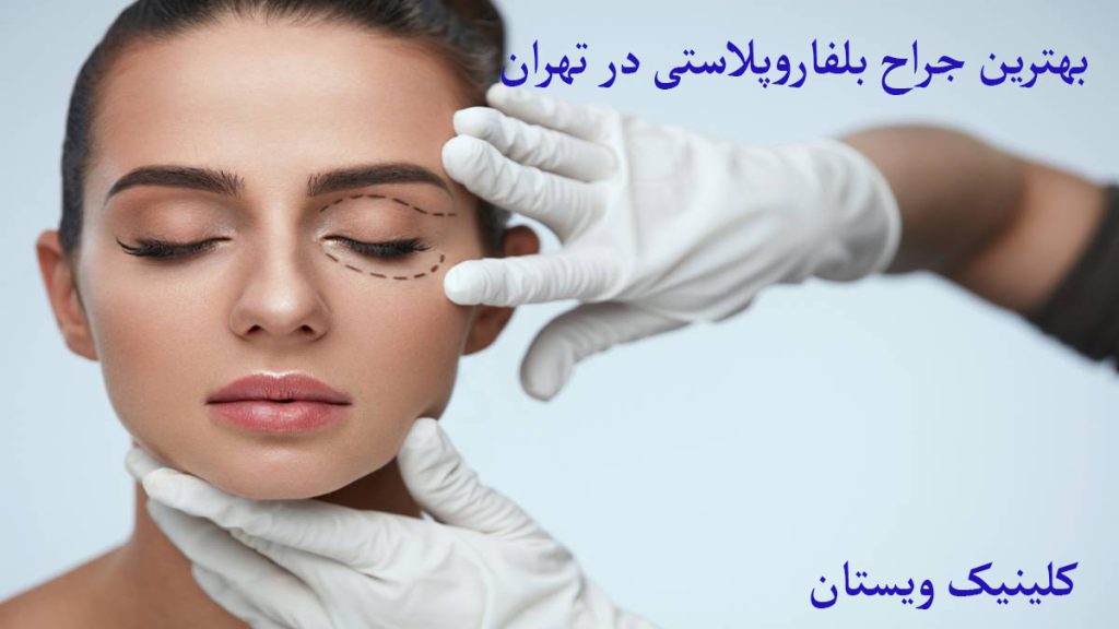 بلفارو پلاستی شخص برای عمل بلفارو پلک توسط چراح معاینه می شود