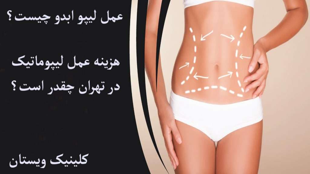 بدن شخص برای عمل لیپو خط کشی شده است