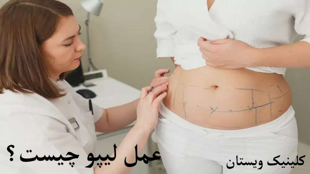 پزشک در حال بررسی بیمار برای عمل لیپو