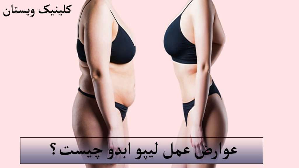 عوارض لیپو شخص قبل و بعد از عمل لیپو