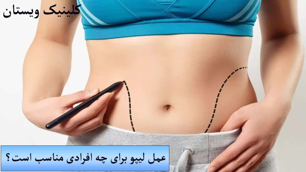 عمل لیپو شکم فرد برای لیپو خط کشی شده است