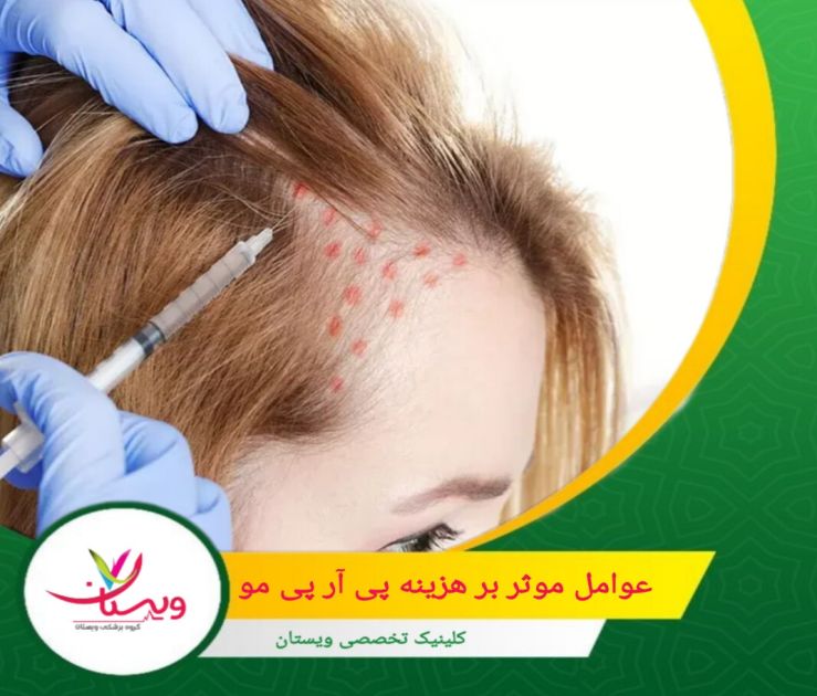 نوع پی آر پی مورد نیاز برای ناحیه تحت درمان بر هزینه تأثیر میگذارد. عوامل موثر بر هزینه پی آر پی مو