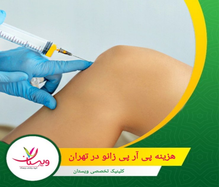 هزینه پی آر پی زانو در تهران