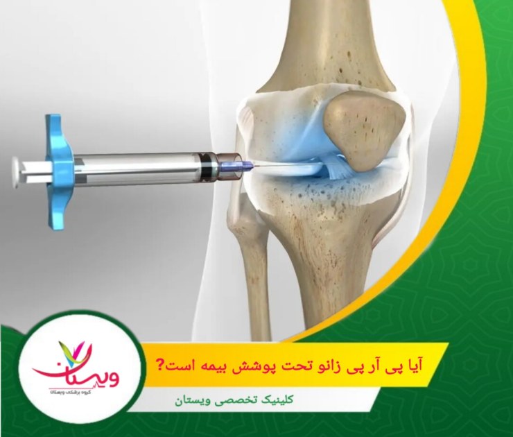 میزان و شرایط این پوشش به نوع بیمهنامه و شرکت بیمهگر بستگی دارد. آیا پی آر پی زانو تحت پوشش بیمه است؟