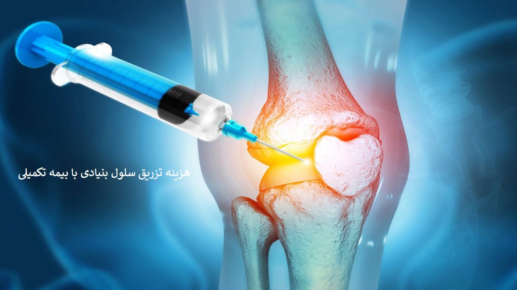 هزینه تزریق سلول بنیادی به زانو با بیمه تکمیلی