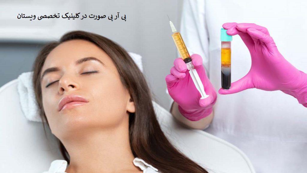 هزینه پی آر پی صورت