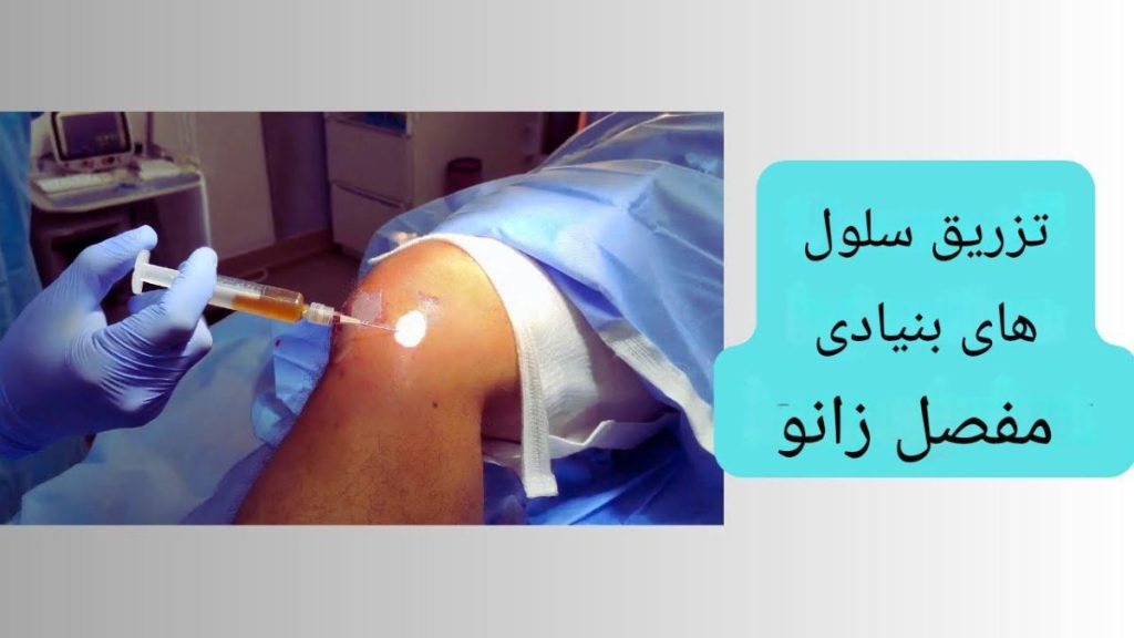هزینه تزریق سلول بنیادی به زانو