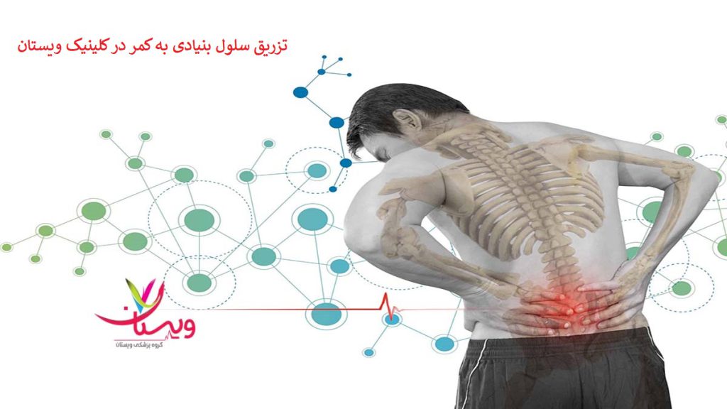 هزینه تزریق سلول بنیادی به کمر