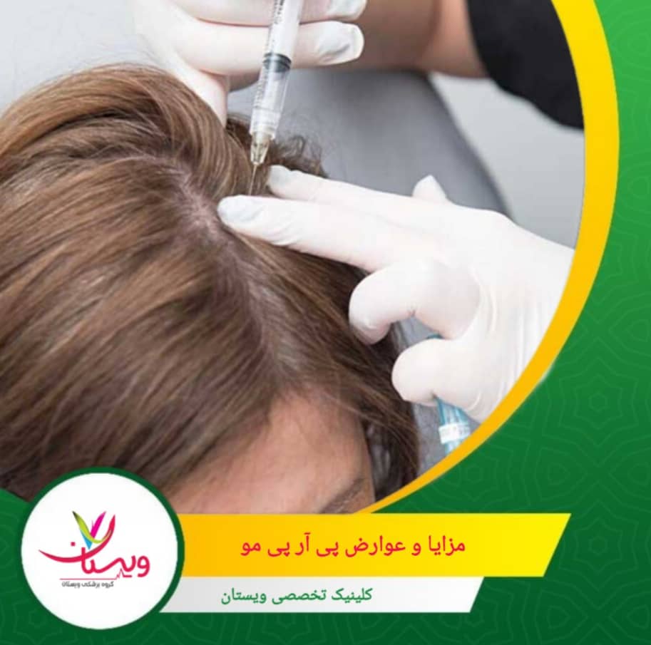 برخلاف جراحی کاشت مو، دوران استراحت کوتاه است و فرد سریع به فعالیتهای روزمره بازمیگردد. مزایا و عوارض پی آر پی مو